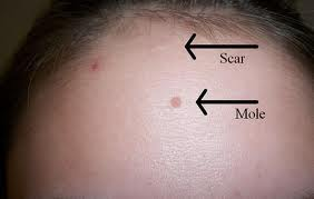 Lucky-moles-on-female-face alastquani